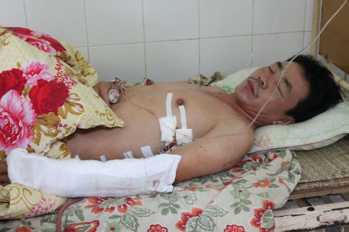 Tài xế Việt bị giang hồ trút cơn mưa đạn trên đất Lào