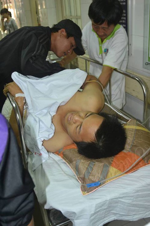 Chàng trai bán bóng bay tiếp tục phải phẫu thuật cột sống