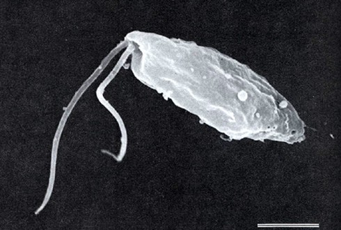 Tử vong nghi do amip “ăn” não: Hơn 1 tuần nữa mới có kết quả chính xác