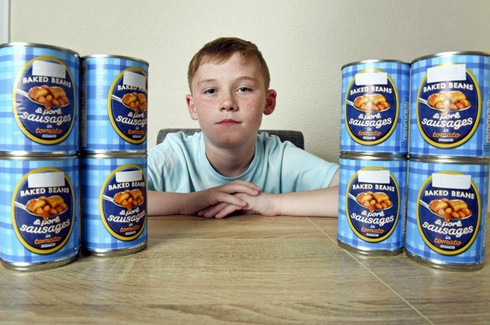 Kỳ lạ cậu bé 11 năm chỉ ăn xúc xích và đậu đóng hộp - ảnh 1
