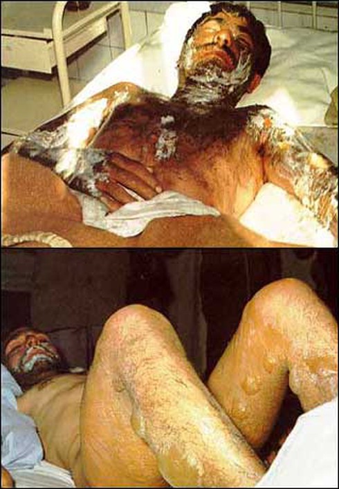 Những vụ tấn công bằng vũ khí hóa học kinh hoàng nhất - ảnh 4