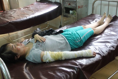 Bị chồng đánh túi bụi, đổ nước sôi lên đầu vì dám đi...xăm lông mày - ảnh 1
