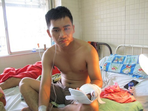 Ngất xỉu khi thấy bạn bị chặt rớt bàn tay - ảnh 1