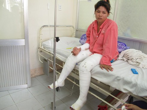 Giận chị, tạt xăng đốt làm 4 người bỏng nặng - ảnh 1