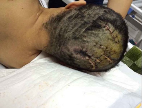 Nghệ An: Khẩn trương điều tra vụ dùng dao chém hàng xóm - ảnh 3