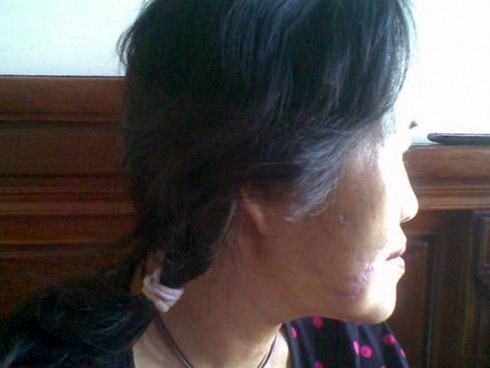 Kinh hoàng chó dữ - ảnh 3