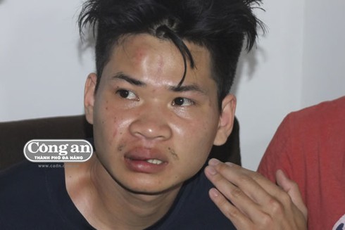 Giải cứu cô gái bị kẻ hoang tưởng khống chế - ảnh 1