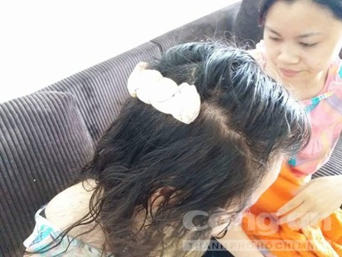 Nữ sinh thoát chết khi bị 2 tên cướp cởi trần áp sát giữa đường - ảnh 2