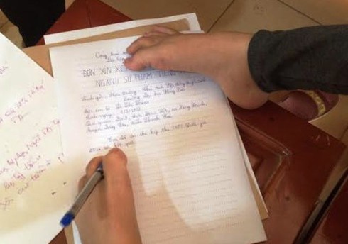 Thí sinh làm bài bằng chân được đặc cách vào thẳng đại học - ảnh 2