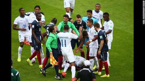 Pháp đã thắng 