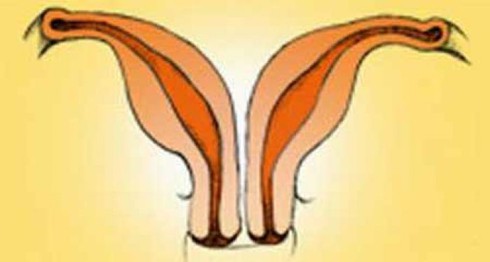 Bị tử cung đôi: 11 năm cưới, 5 lần sảy thai - ảnh 1