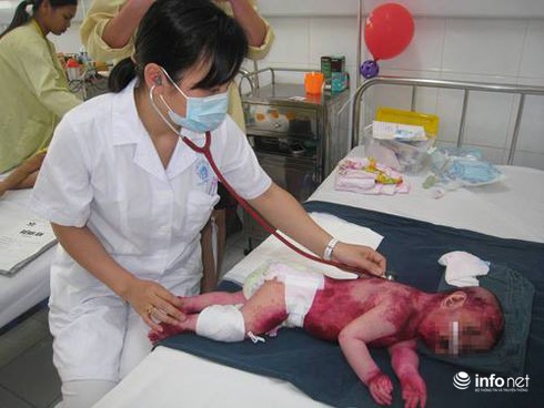Trẻ phồng rộp, tróc da toàn thân, mắt suýt mù vì tự ý dùng thuốc - ảnh 1