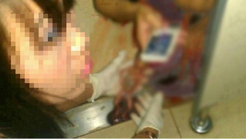 Lan truyền bức ảnh nữ sinh phá thai tại nhà gây sốc - ảnh 1