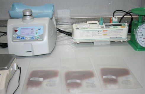 Quy trình bảo quản tế bào gốc nghiêm ngặt như thế nào? - ảnh 5