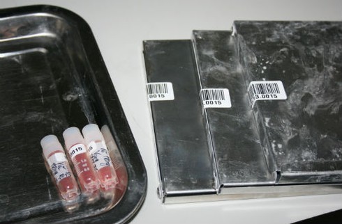 Quy trình bảo quản tế bào gốc nghiêm ngặt như thế nào? - ảnh 9