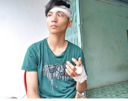 Khởi tố nhóm côn đồ xông vào UBND phường chém người - ảnh 1