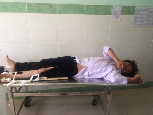 CSGT bị hai thanh niên lái xe máy tông gãy chân - ảnh 1