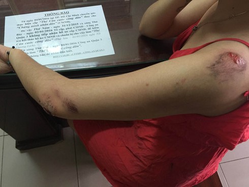 Dân mong Bí thư Thăng sớm mang lại