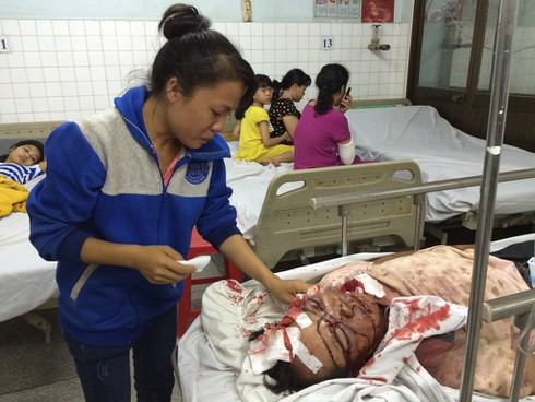 Bị chém nguy kịch vì... hẹn mua đầu trâu - ảnh 1