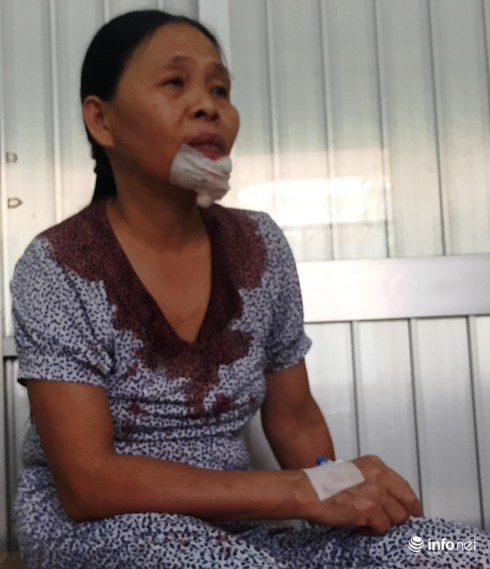 Vụ tai nạn ở Bình Thuận: Phải sớm xác định ADN của các nạn nhân - ảnh 3