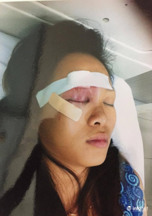 Ba người bán hàng rong bị nhóm thanh niên truy sát - ảnh 1