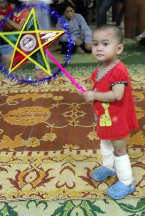 Trung thu đầu tiên của cô bé mắc bệnh hiểm nghèo bị bỏ rơi - ảnh 1