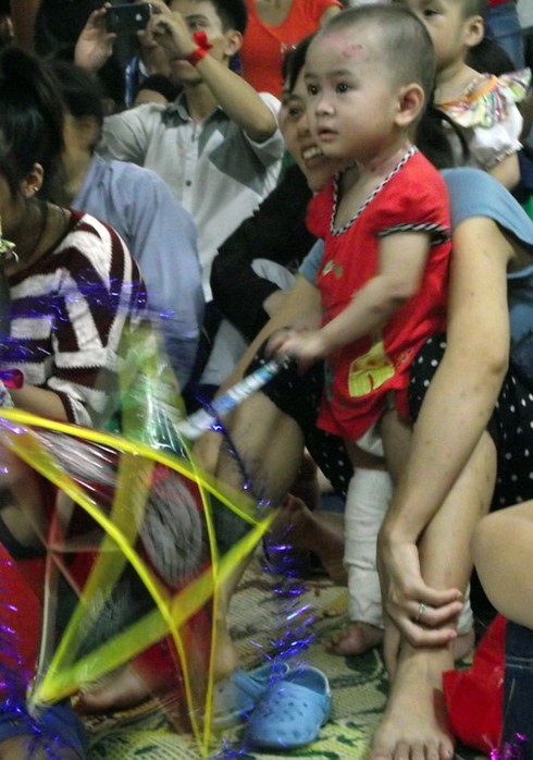 Trung thu đầu tiên của cô bé mắc bệnh hiểm nghèo bị bỏ rơi - ảnh 2