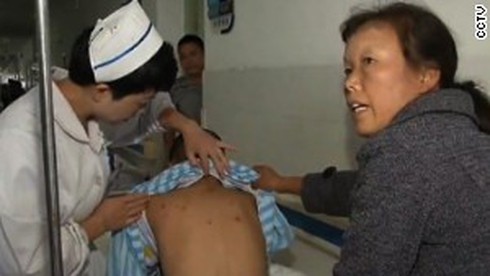 Trung Quốc: Ong bắp cày giết 41 người, gần 1.7000 người bị thương - ảnh 1