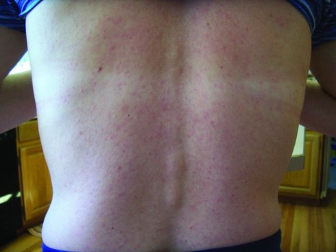 Những điều chưa biết về virus Zika - ảnh 1