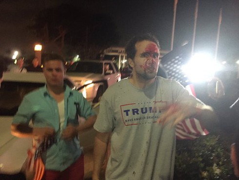 Dân California biểu tình chống Donald Trump - ảnh 1