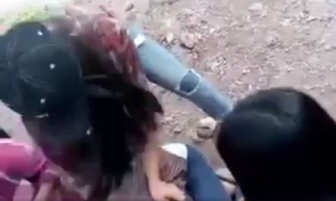 Nghệ An: Nữ sinh bị đánh chảy máu mắt vì không trả lời tin nhắn qua facebook - ảnh 2