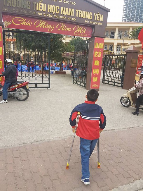 Học sinh gãy chân tại trường tiểu học Nam Trung Yên đã trở lại lớp học - ảnh 1