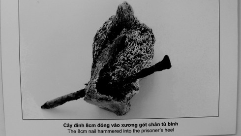 Những hình ảnh đau thương tại nhà tù Phú Quốc - ảnh 13