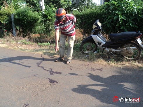 Nam thanh niên bị đâm chém đứt lìa bàn tay giữa đường - ảnh 1