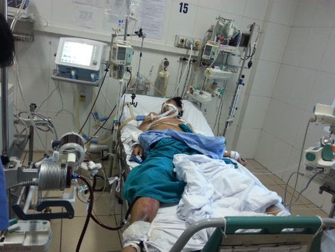 Hôn mê vì cúm: Phổi tê liệt, phải bơm oxy thẳng vào máu - ảnh 1