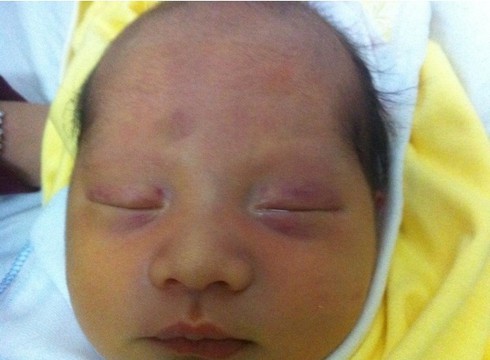 Bị tắm quá sớm, một trẻ sơ sinh suy hô hấp, nguy kịch - ảnh 1