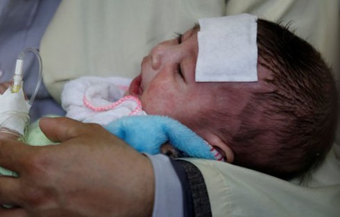 Người có triệu chứng như nào không nên đi chơi dịp 30/4 - ảnh 1