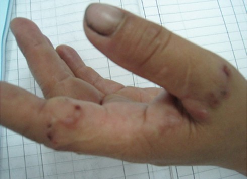 Sống giữa thủ đô vẫn bị giun bò khắp người - ảnh 2