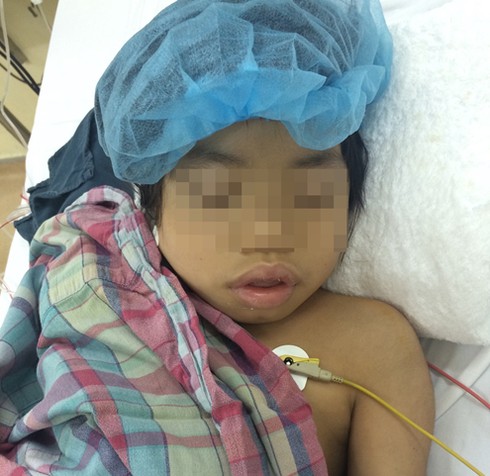 Ghép thận cứu cháu bé 11 tuổi bị suy thận giai đoạn cuối - ảnh 1