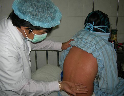 Xuất hiện ổ dịch rubella tại Bình Dương: 138 ca nghi nhiễm - ảnh 1