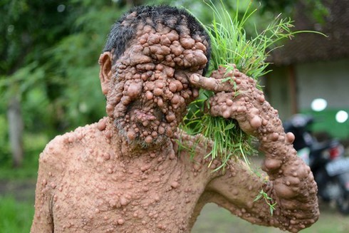 Căn bệnh dai dẳng khiến bác sĩ không thể quên được bệnh nhân - ảnh 1