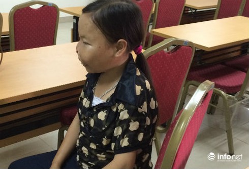 Căn bệnh khiến thiếu nữ mãi ở trong hình hài trẻ em - ảnh 1