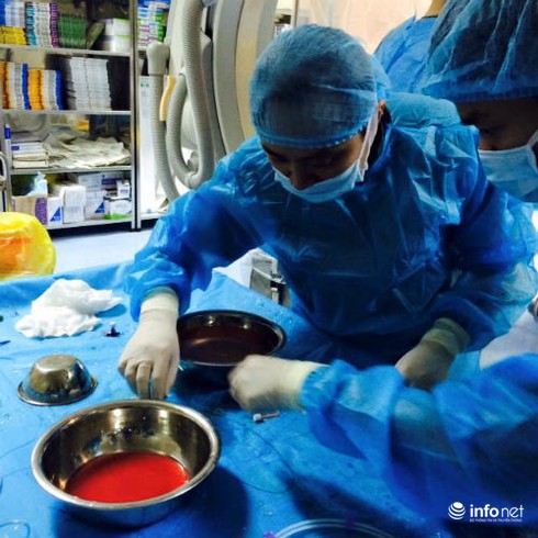 Thủ phạm hàng đầu gây ra đột quỵ - ảnh 1