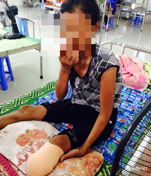 Cảnh báo chứng bệnh đơn giản nhưng có thể mất chân - ảnh 1