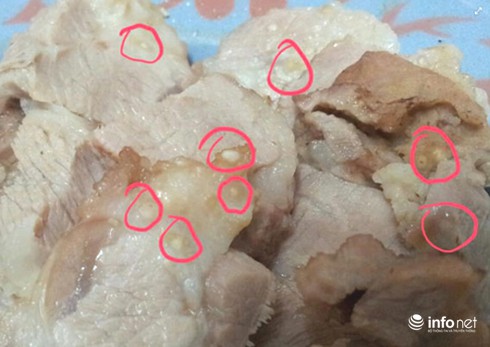 Dấu hiệu nhiễm sán dây lợn, biết muộn có thể viêm não, mù mắt! - ảnh 1