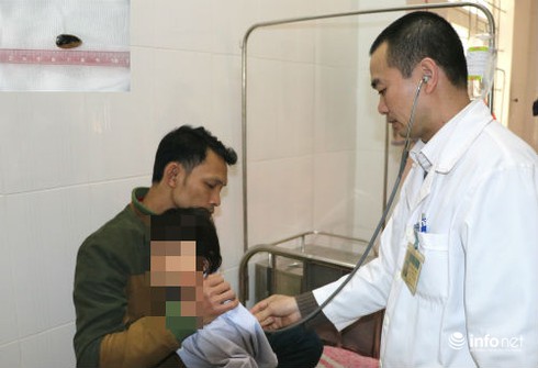 Nhiều tai nạn hóc hạt hướng dương nguy hiểm ở trẻ nhỏ dịp Tết - ảnh 1