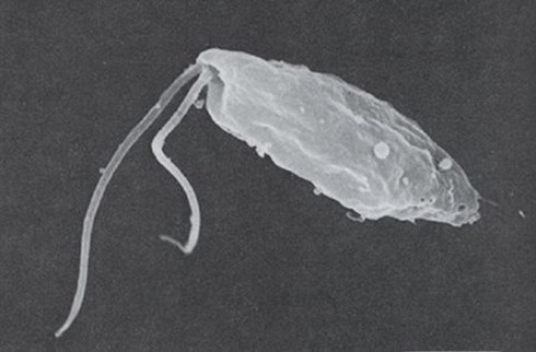 Kinh khủng loài vật ăn hồng cầu và thích làm tổ ở não, gan người - ảnh 1