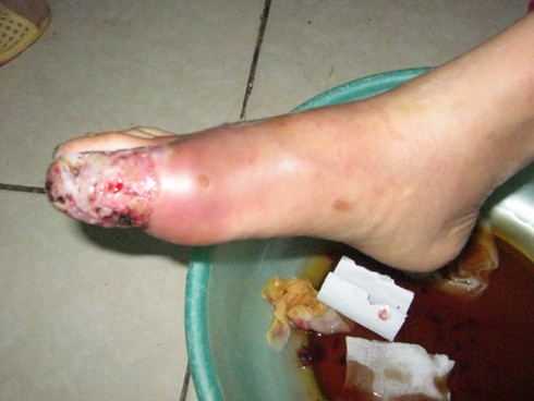 Gặp những bệnh này cần nói không với đông y - ảnh 1