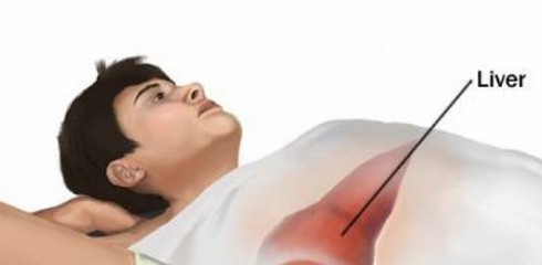 Truy tìm thủ phạm khiến ung thư gan tấn công cả gia đình - ảnh 1