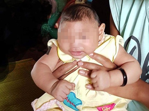Bé 4 tháng tuổi nghi bị mắc chứng đầu nhỏ do virus Zika - ảnh 1